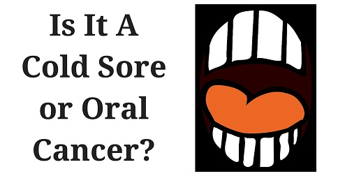 Wayne NJ Dentist Shares Common Oral Cancer Symptoms