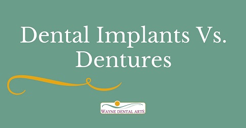 Wayne NJ Dental Implants Vs Dentures