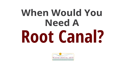 Non-Surgical Root Canal Treatment in Wayne NJ by Frank V. Maldonado DDS