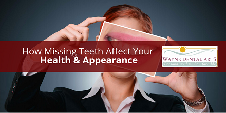 How Missing Teeth Affect Your Health & Appearance