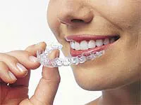 clear braces