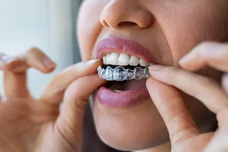 A person holding a clear dental aligner between their fingers near their mouth.